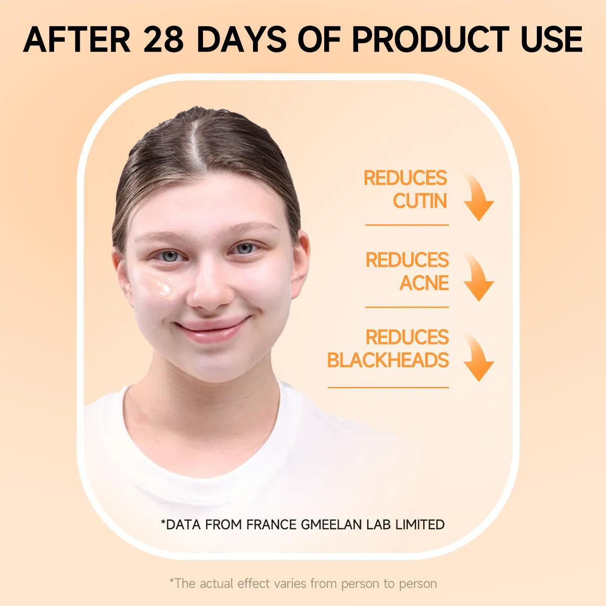 Orange LF16-35 With FREE Delivery